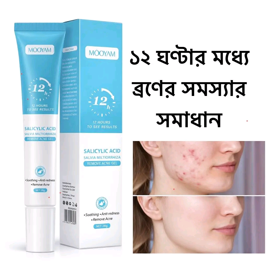 Mooyam Salicylic Acid Remove Acne Gel