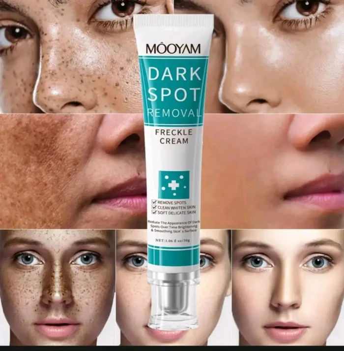 MOOYAM Dark Spot Removal Freckle Cream (30g)