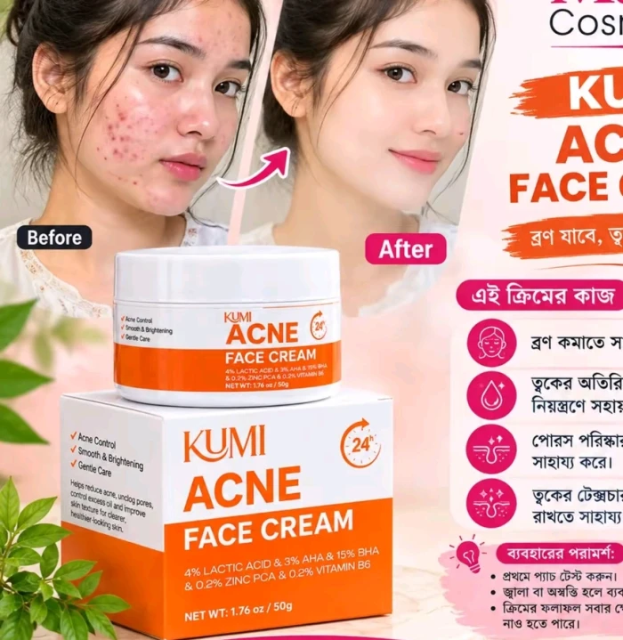 ✨ KUMI Acne Face Cream ✨